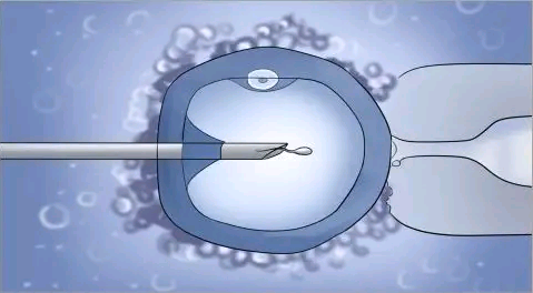 上海添喜助孕[哪里能做供卵],鹰潭试管婴儿攻略：试管前为什么要检查染色体
